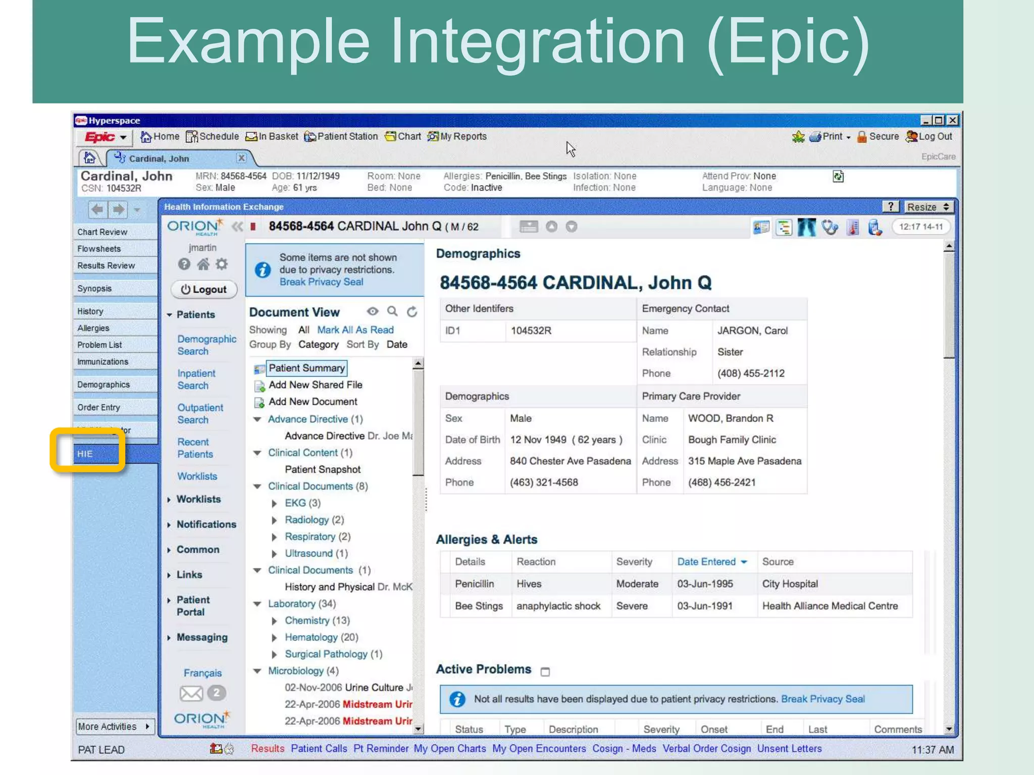 Example Integration (Epic)
 