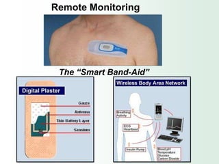Remote Monitoring




 The “Smart Band-Aid”
 