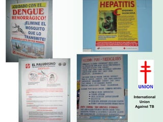 International
    Union
 Against TB
 