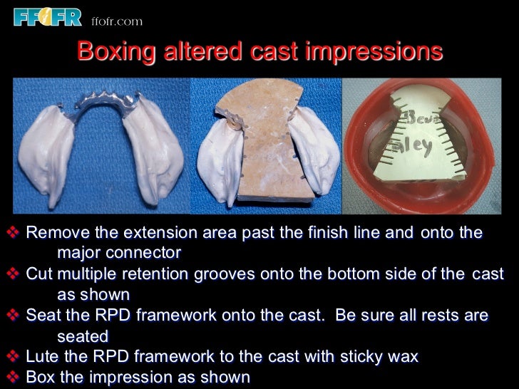 9 impressions and physiologic adjustment altered cast technique