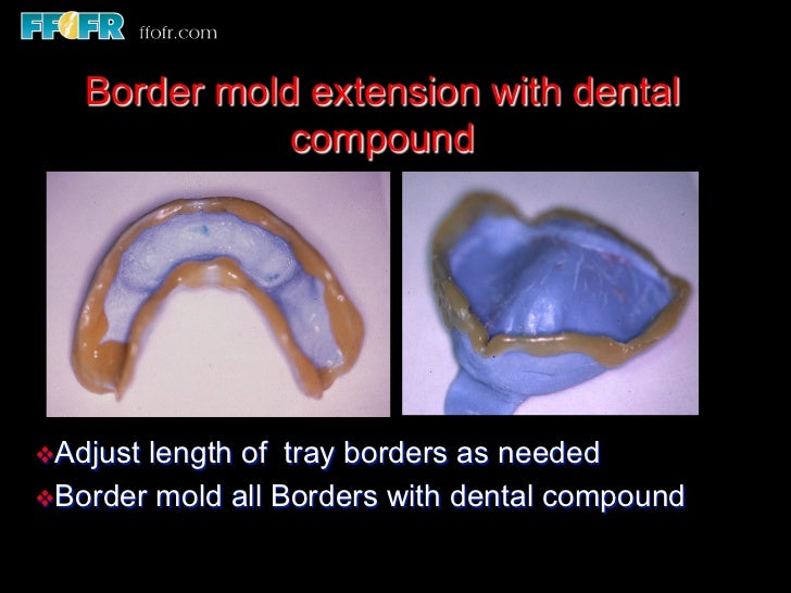 9.impressions and physiologic adjustment