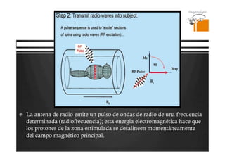Pregrado – Dr Yee
  La antena de radio emite un pulso de ondas de radio de una frecuencia
determinada (radiofrecuencia); esta energia electromagnética hace que
los protones de la zona estimulada se desalineen momentáneamente
del campo magnético principal.
 