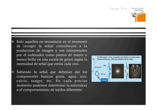 Pregrado – Dr Yee
  Solo aquellos en resonancia en el momento
de recoger la señal contribuyen a la
produccion de imagen y son interpretados
por el ordenador como puntos de mayor o
menor brillo en una escala de grises según la
intensidad de señal que emita cada uno.
  Sabiendo la señal que deberian dar los
componentes basicos grasa, agua, aire,
calcio, sangre, etc. En cada preciso
momento podemos determinar la naturaleza
o el comportamiento de tejidos diferentes.
 