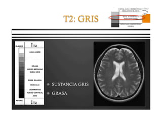 Pregrado – Dr Yee
T2: GRIS
  SUSTANCIA GRIS
  GRASA
 