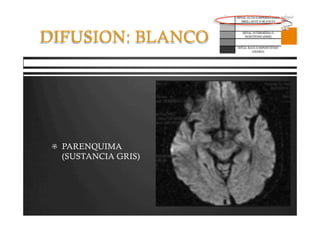 Pregrado – Dr Yee
DIFUSION: BLANCO
  PARENQUIMA
(SUSTANCIA GRIS)
 