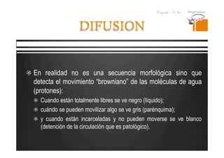 Pregrado – Dr Yee
DIFUSION
  En realidad no es una secuencia morfológica sino que
detecta el movimiento “browniano” de las moléculas de agua
(protones):
  Cuando están totalmente libres se ve negro (líquido);
cuándo se pueden movilizar algo se ve gris (parénquima);
  y cuando están incarceladas y no pueden moverse se ve blanco
(detención de la circulación que es patológico).
 