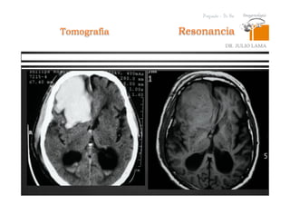 Pregrado – Dr Yee
Resonancia
DR. JULIO LAMA
Tomografia
 