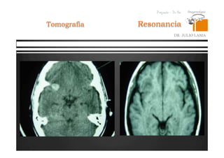 Pregrado – Dr Yee
Resonancia
DR. JULIO LAMA
Tomografia
 