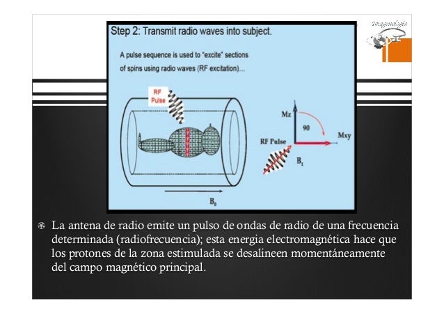 Resonancia Magnetica