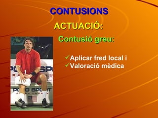 CONTUSIONS ACTUACIÓ: Contusió greu: Aplicar fred local i Valoració mèdica 