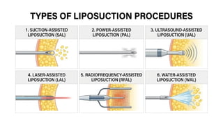 Liposuction Method Liposuction Techniques & Procedures Explained | Complete Surgical ...