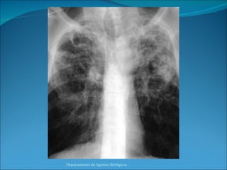 Departamento de Agentes Biológicos 