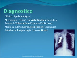 Clínico - Epidemiológico Microscopia – Tinción de  Ziehl Neelsen  Serie de 3. Prueba de  Tuberculina  (Pacientes Pediátricos) Medio de cultivo  Löwenstein-Jensen  (3 semanas). Estudios de Imagenología  (Foco de  Gonh ) Departamento de Agentes Biológicos 