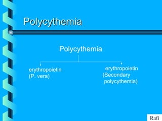 BIKHABIKHA
PolycythemiaPolycythemia
Polycythemia
erythropoietin
(P. vera)
erythropoietin
(Secondary
polycythemia)
Rafi
 