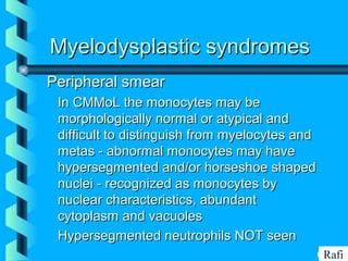 BIKHABIKHA
Myelodysplastic syndromesMyelodysplastic syndromes
Peripheral smearPeripheral smear
• In CMMoL the monocytes may beIn CMMoL the monocytes may be
morphologically normal or atypical andmorphologically normal or atypical and
difficult to distinguish from myelocytes anddifficult to distinguish from myelocytes and
metas - abnormal monocytes may havemetas - abnormal monocytes may have
hypersegmented and/or horseshoe shapedhypersegmented and/or horseshoe shaped
nuclei - recognized as monocytes bynuclei - recognized as monocytes by
nuclear characteristics, abundantnuclear characteristics, abundant
cytoplasm and vacuolescytoplasm and vacuoles
• Hypersegmented neutrophils NOT seenHypersegmented neutrophils NOT seen
Rafi
 