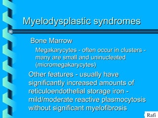 BIKHABIKHA
Myelodysplastic syndromesMyelodysplastic syndromes
Bone MarrowBone Marrow
• Megakarycytes - often occur in clusters -Megakarycytes - often occur in clusters -
many are small and uninucleatedmany are small and uninucleated
(micromegakarycytes)(micromegakarycytes)
Other features - usually haveOther features - usually have
significantly increased amounts ofsignificantly increased amounts of
reticuloendothelial storage iron -reticuloendothelial storage iron -
mild/moderate reactive plasmocytosismild/moderate reactive plasmocytosis
without significant myelofibrosiswithout significant myelofibrosis
Rafi
 