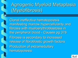 BIKHABIKHA
Agnogenic Myeloid MetaplasiaAgnogenic Myeloid Metaplasia
(Myelofibrosis)(Myelofibrosis)
Clonal ineffective hematopoiesisClonal ineffective hematopoiesis
manifesting marrow hypercellularity andmanifesting marrow hypercellularity and
fibrosis with myeloerythroblastosis infibrosis with myeloerythroblastosis in
the peripheral blood - Causes pg 378the peripheral blood - Causes pg 378
Fibrosis is secondary to increasedFibrosis is secondary to increased
release of fibroblastic growth factorsrelease of fibroblastic growth factors
Production of extramedullaryProduction of extramedullary
hematopoiesishematopoiesis
Rafi
 