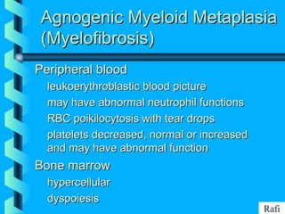 BIKHABIKHA
Agnogenic Myeloid MetaplasiaAgnogenic Myeloid Metaplasia
(Myelofibrosis)(Myelofibrosis)
Peripheral bloodPeripheral blood
• leukoerythroblastic blood pictureleukoerythroblastic blood picture
• may have abnormal neutrophil functionsmay have abnormal neutrophil functions
• RBC poikilocytosis with tear dropsRBC poikilocytosis with tear drops
• platelets decreased, normal or increasedplatelets decreased, normal or increased
and may have abnormal functionand may have abnormal function
Bone marrowBone marrow
• hypercellularhypercellular
• dyspoiesisdyspoiesis
Rafi
 