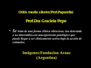 Otitis media silente( Prof.Paparella)

             Prof.Dra Graciela Pepe

• Se trata de una forma clínica silenciosa, (no detectada
  o no detectable),con mucoperiostio patológico que
  puede llegar a ser clínicamente activa bajo la acción de
  estímulos.


          Imágenes:Fundacion Arauz
                (Argentina)
 