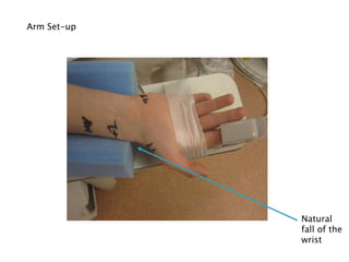 Arm Set-up
Natural
fall of the
wrist
 