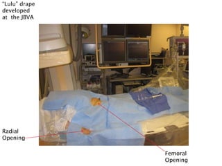“Lulu” drape
developed
at the JBVA
Radial
Opening
Femoral
Opening
 