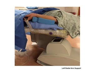 Left Radial Arm Support
 