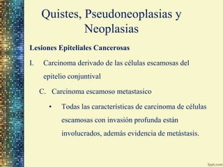 Quistes, Pseudoneoplasias y
              Neoplasias
Neoplasias Estromales
I.   Angiomatosos
II. Pseudotumores, hiperplasi...