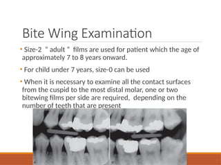 The Use of Radiographs in Detecting and Diagnosing Dental Caries-pptx.pptx