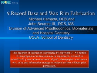 9. Record Base and Wax Rim Fabrication   Michael Hamada, DDS and John Beumer III,  DDS, MS Division of Advanced Prosthodontics, Biomaterials and Hospital Dentistry UCLA  School of Dentistry This program of instruction is protected by copyright ©.  No portion of this program of instruction may be reproduced, recorded or transferred by any means electronic, digital, photographic, mechanical etc., or by any information storage or retrieval system, without prior permission. 