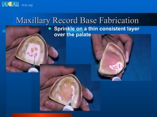 Maxillary Record Base Fabrication   Sprinkle on a thin consistent layer over the palate 
