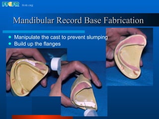 Mandibular Record Base Fabrication   Manipulate the cast to prevent slumping Build up the flanges 