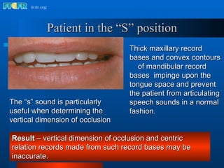 Thick maxillary record bases and convex contours  of mandibular record bases  impinge upon the tongue space and prevent the patient from articulating speech sounds in a normal fashion .  Result  – vertical dimension of occlusion and centric relation records made from such record bases may be inaccurate. The “s” sound is particularly useful when determining the vertical dimension of occlusion Patient in the “S” position 