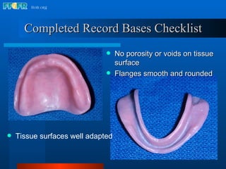 Completed Record Bases Checklist No porosity or voids on tissue surface Flanges smooth and rounded Tissue surfaces well adapted 
