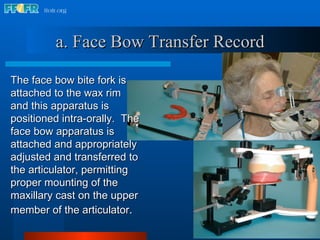 a.   Face Bow Transfer Record The face bow bite fork is attached to the wax rim and this apparatus is positioned intra-orally.  The face bow apparatus is attached and appropriately adjusted and transferred to the articulator, permitting proper mounting of the maxillary cast on the upper member of the articulator . 