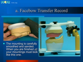 a. Facebow Transfer Record The mounting is carefully smoothed and sanded.  When you are finished  all  your mountings must look like this one. 