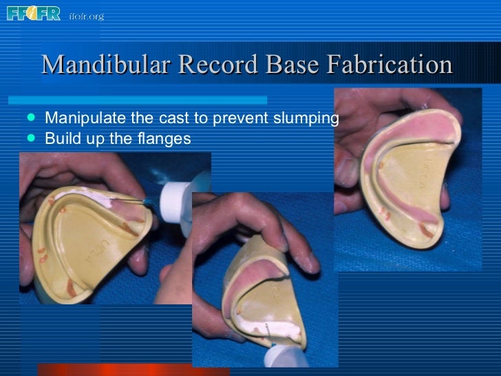 9.record base and wax rim fabrication