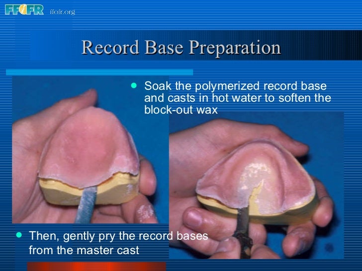 9.record base and wax rim fabrication