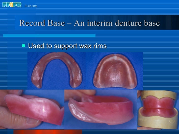 9.record base and wax rim fabrication