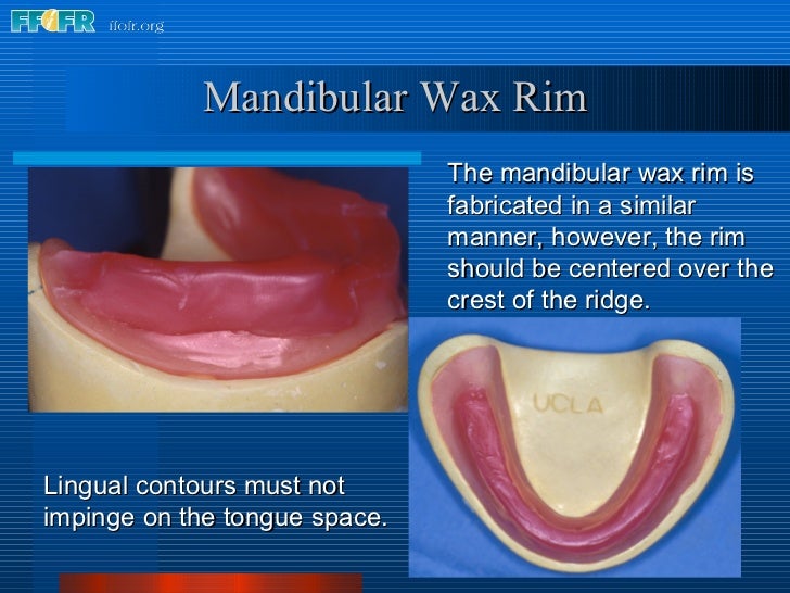 9.record base and wax rim fabrication