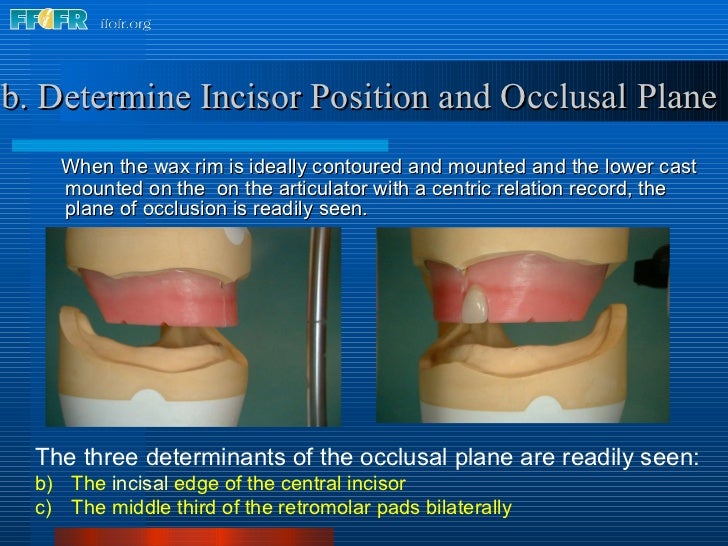 9.record base and wax rim fabrication