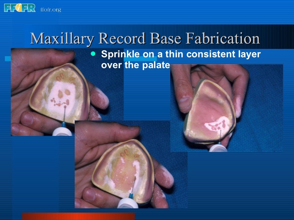 9.record base and wax rim fabrication
