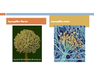 Aspergillus flavus Aspergillus ustus
 