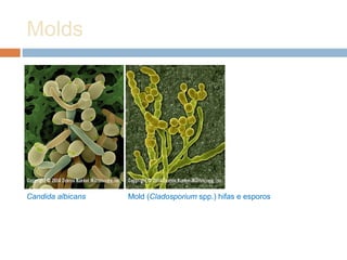 Molds
Candida albicans Mold (Cladosporium spp.) hifas e esporos
 