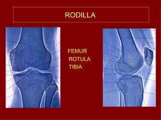 RODILLA   FEMUR ROTULA TIBIA 