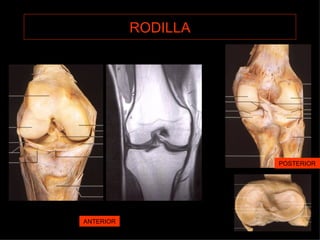 RODILLA ANTERIOR POSTERIOR 