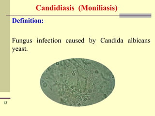 9 - sexual transmitted disease modified.pptx