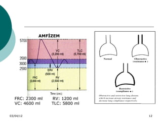 AMFİZEM




   FRC: 2300 ml   RV: 1200 ml
   VC: 4600 ml    TLC: 5800 ml


03/04/12                         12
 