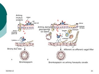 Artmış
           mukus
           üretimi


                            Artmış damar
                             geçirgenliği
                               ve ödem




 Bronş düz kası                                     Afferent ve efferent vagal lifler




              Bronkospazm             Bronkospazm ve artmış havayolu cevabı



03/04/12                                                                          21
 