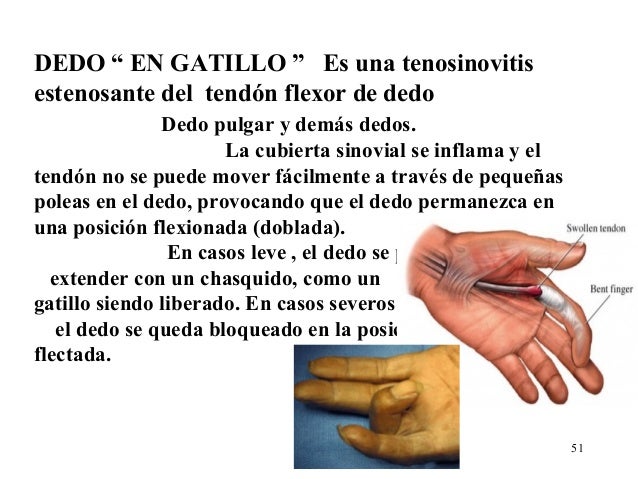 Siento un dedo en mi culito 5