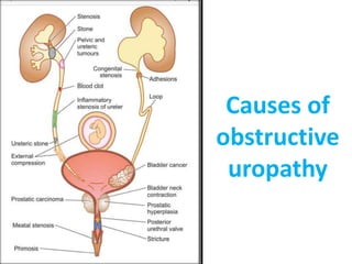 Curated visual reference: The Kidney Obstructive Uropathy Photo Inspiration